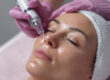 microneedling pompano beach