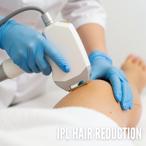 IPL hair reduction treatment on a client's leg at Skinfluencer Spa in Pompano Beach