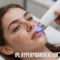 IPL treatment for hyperpigmentation on a client's face in Pompano Beach, FL
