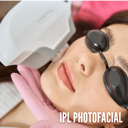 ipl photofacials pompano beach