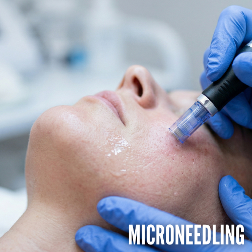 microneedling pompano beach